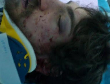 Σε κατάσταση σοκ ο πατέρας του φοιτητή που έπεσε θύμα ξυλοδαρμού - Τι αναφέρει